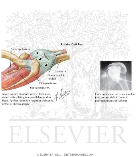Disorders of the Shoulder