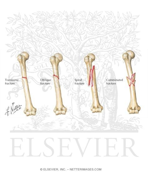 humeral shaft