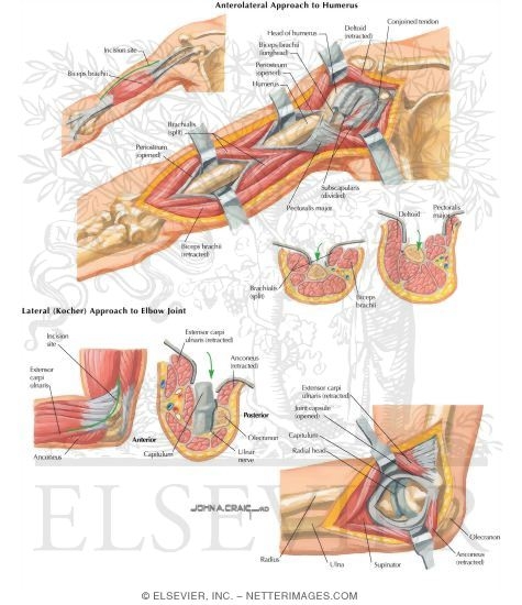Surgical Approaches to the Arm
