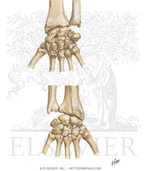 Carpal Bones