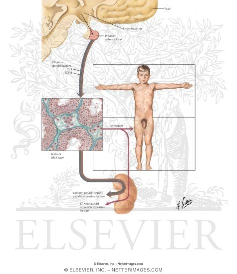 Sexual Precocity I - Celebral Type