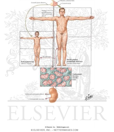 Testicular Failure II - Secondary or Hypogonadotropic Hypogonadism