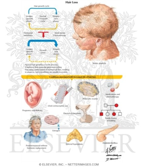 Hair Loss