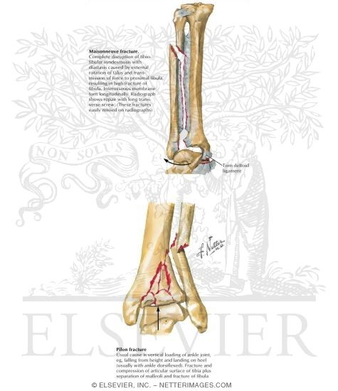 Trauma of the Leg and Knee