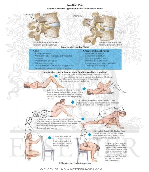 Low Back Pain