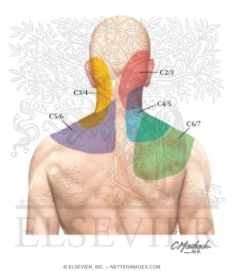Cervical Zygapophyseal Pain Syndromes