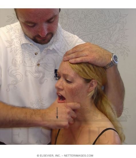Assessment of Pain During Passive Opening