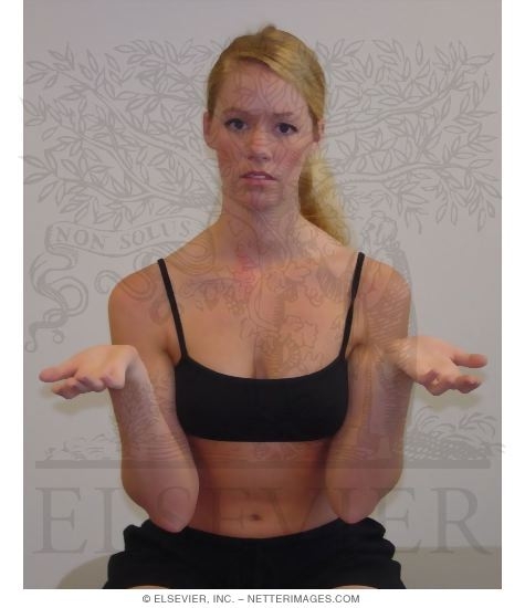 Elbow and Flexion Test With Shoulders In Neutral and Wrists In Extended
