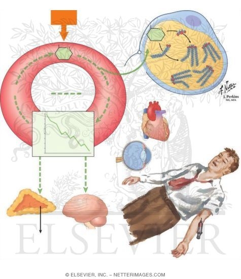 Statistics hypoglycemia |diabetic hypoglycemia ...