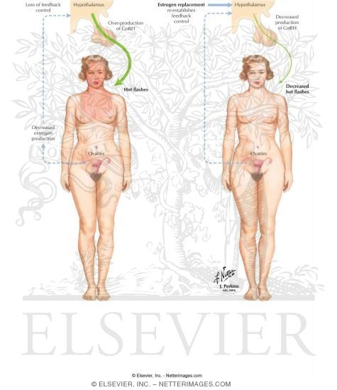 Vasomotor Symptoms