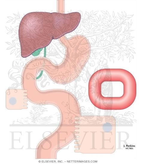 Fat-Soluable Vitamin-Drug Interactions