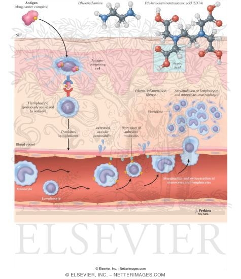 Type 4 (Cell-Mediated, Delayed-Hypersensitivity, Contact Dermatitis) 