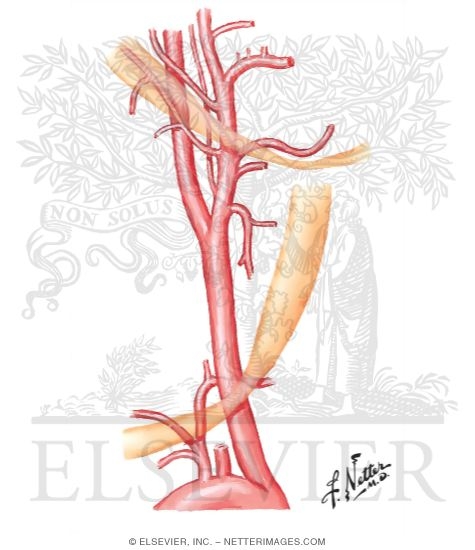 Arterial Supply of the Inner Ear