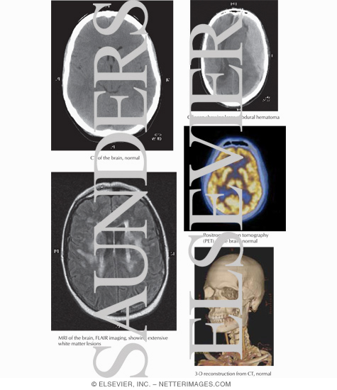 Brain and Spine Imaging