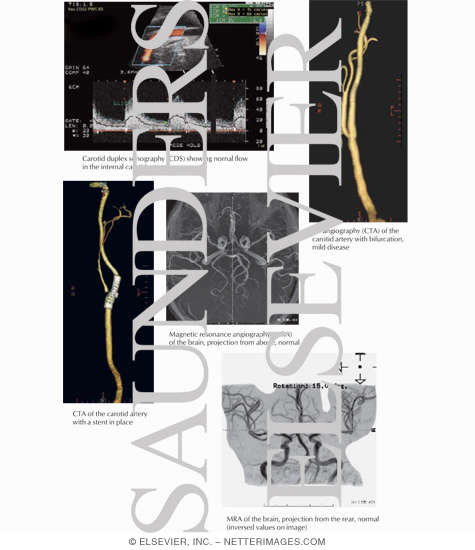 Vascular Imaging