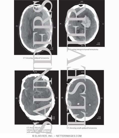 General Features of Hemorrhage