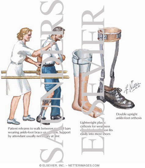 Rehabilitation
