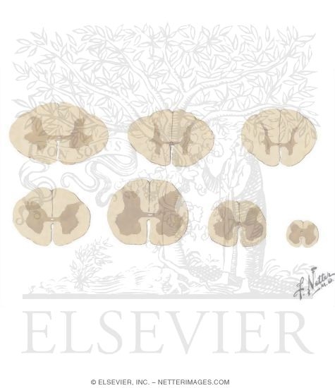 Section Through Spinal Cord at Various Levels