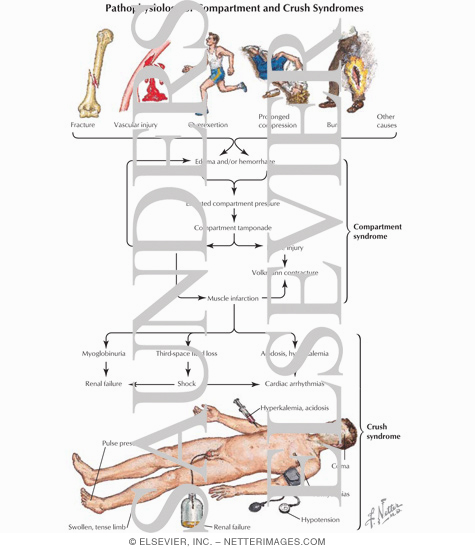 Pathophysiology of Compartment and Crush Syndromes