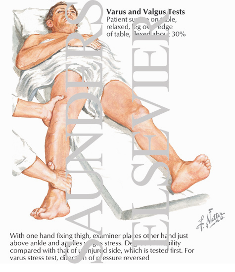 Abduction Stress (Forced Valgus) Test and Adduction Stress (Forced Varus) Test