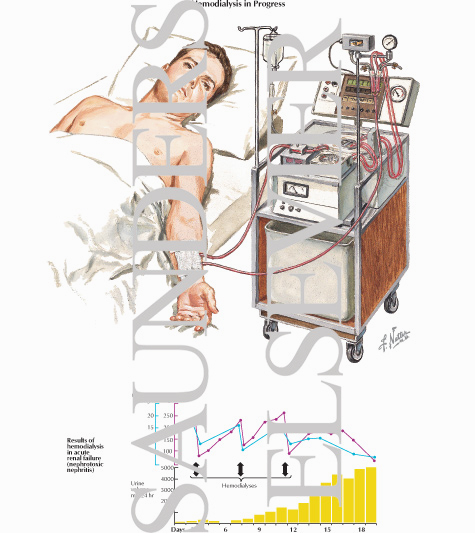 Hemodialysis in Progress