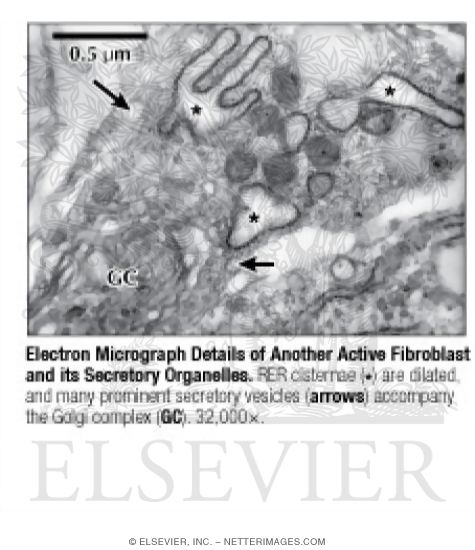 Electron Micrograph Details of Another Active Fibroblast and Its Secretory Organelles