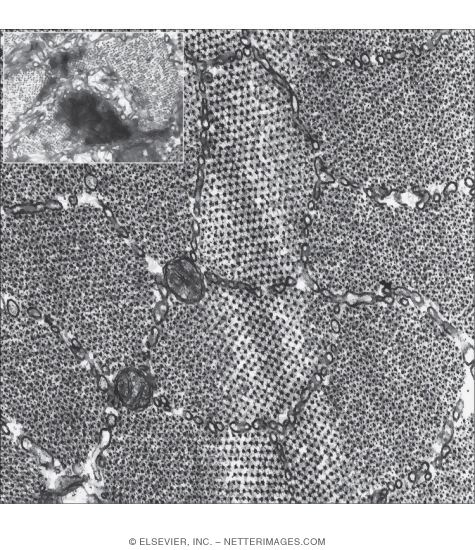 Electron Micrograph of Part of a Skeletal Muscle Fiber Showing Myofibrils In Transverse Section