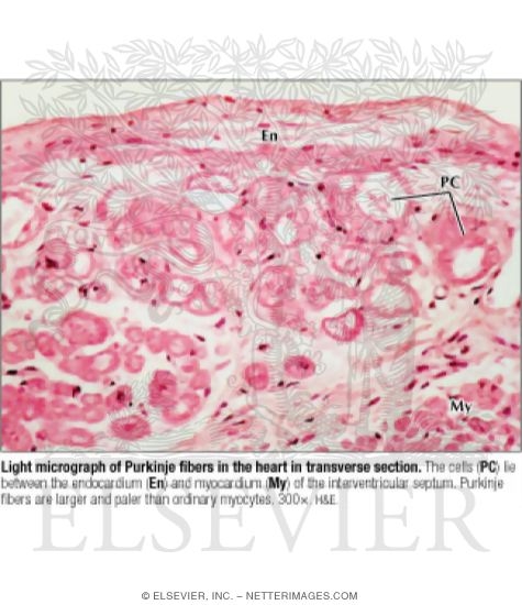 Purkinje Fibers Histology