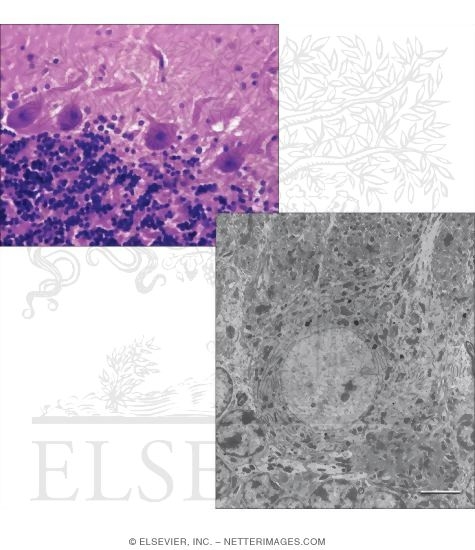 Higher Magnification Light Micrograph of the Cerebellar Cortex With Electron Micrograph of Part of the Cerebellar Cortex