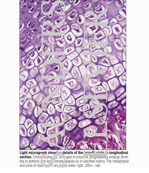 Light Micrograph Showing Details of the Growth Plate In Longitudinal Section