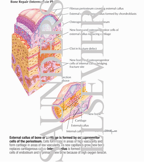 Bone Repair (Intermediate Phase)