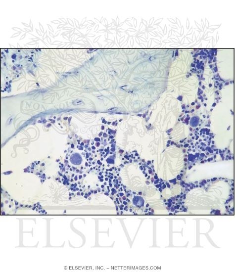Light Micrograph Showing the Architecture of the Bone Marrow