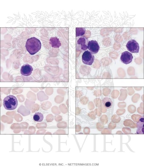 Bone Marrow Smears Showing Different Stages of Erythropoiesis