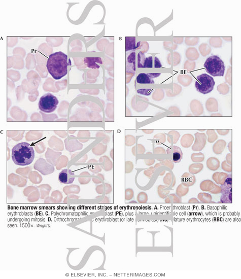 Bone Marrow Smears Showing Different Stages of Erythropoiesis