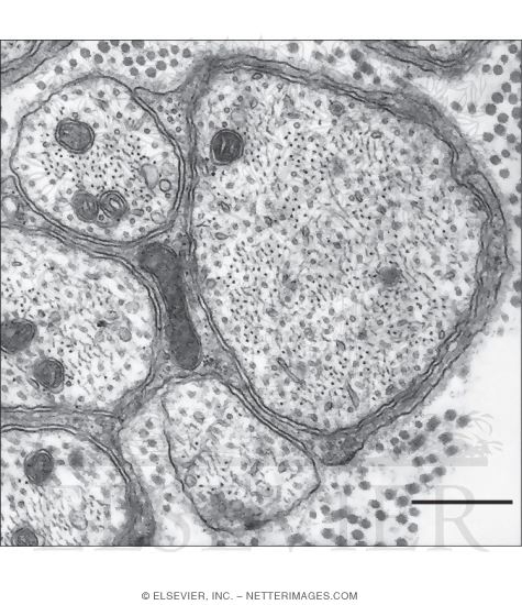 Electron Micrograph of Conducting Segments of Unmyelinated Axons In the Adventitia