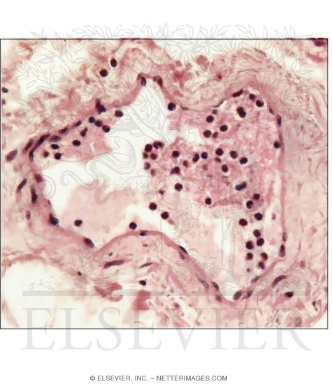 Light Micrograph of a Lymphatic Capillary In Transverse Section