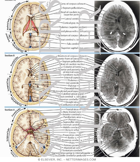 Normal Ct Brain Anatomy Pdf