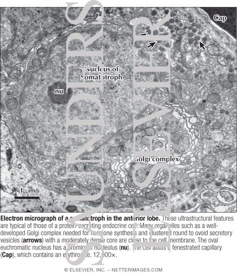 Electron Micrograph of a Somatotroph In the Anterior Lobe