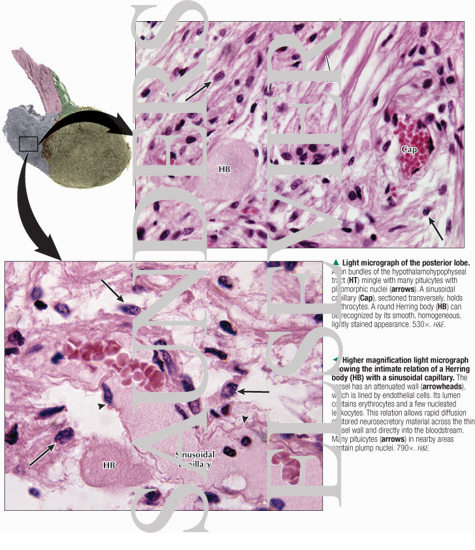 Light Micrograph of the Posterior Lobe With Higher Magnification Light Micrograph