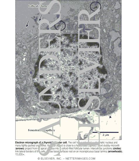Electron Micrograph of a Thyroid Follicular Cell