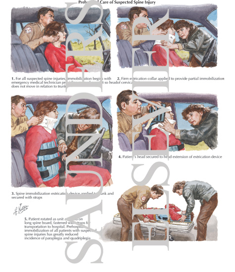 Prehospital Care of Suspected Spine Injury
