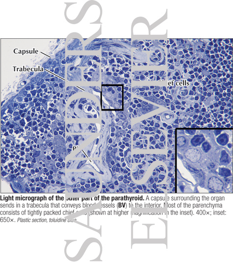 Light Micrograph of the Outer Part of the Parathyroid