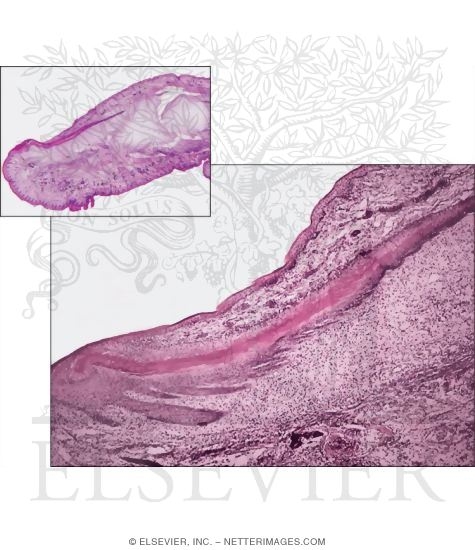 Light Micrograph of a Fetal Nail In Longitudinal Section With Light Micrograph of Part of a Fetal Phalanx In Longitudinal Section