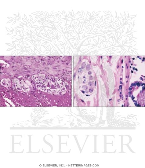 Light Micrographs of the Myenteric (Left) and Submucosal (Right) Plexuses In the Appendix