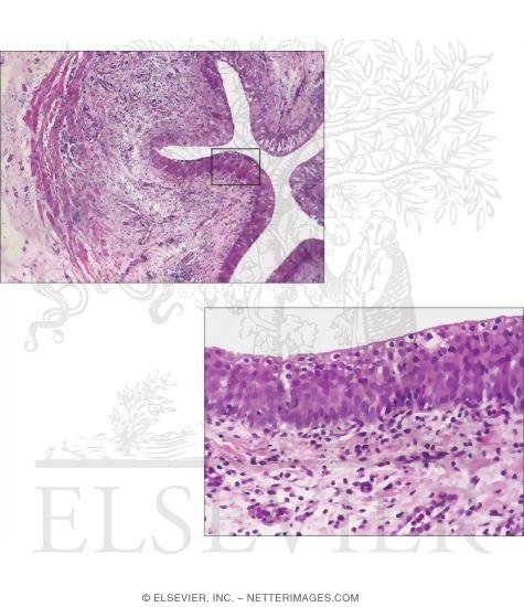 Light Micrograph of the Wall of the Ureter In Transverse Section With Higher Magnification Light Micrograph of the Mucosa of the Ureter Showing Details of the Multilayer Urothelium