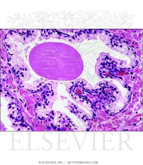 Higher Magnification Light Micrograph of the Prostate