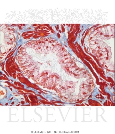 Higher Magnification Light Micrograph of a Secretory Alveolus In the Prostate