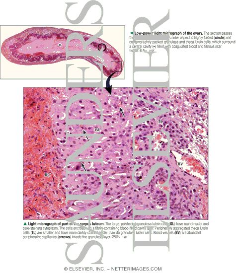 Low-power Light Micrograph of the Ovary With Light Micrograph of Part of the Corpus Luteum
