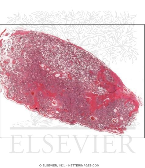 Panoramic Light Micrograph of Part of the Placenta at Low Magnification
