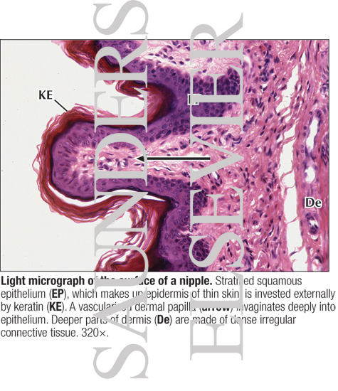 Light Micrograph of the Surface of a Nipple